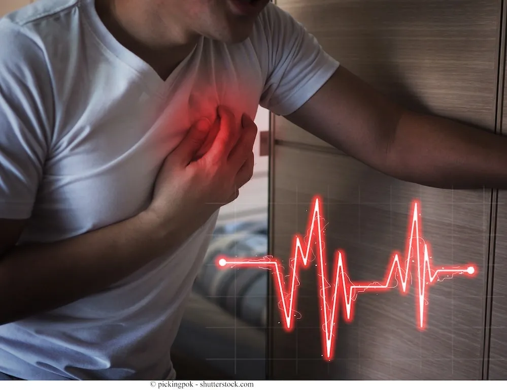 Infarto-acuto-del-miocardio