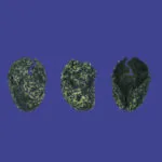 Google Doodle celebra il 32° compleanno di Tim Bergling